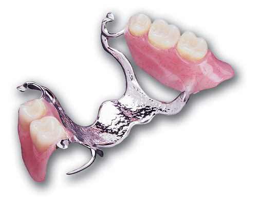 Partial Dentures