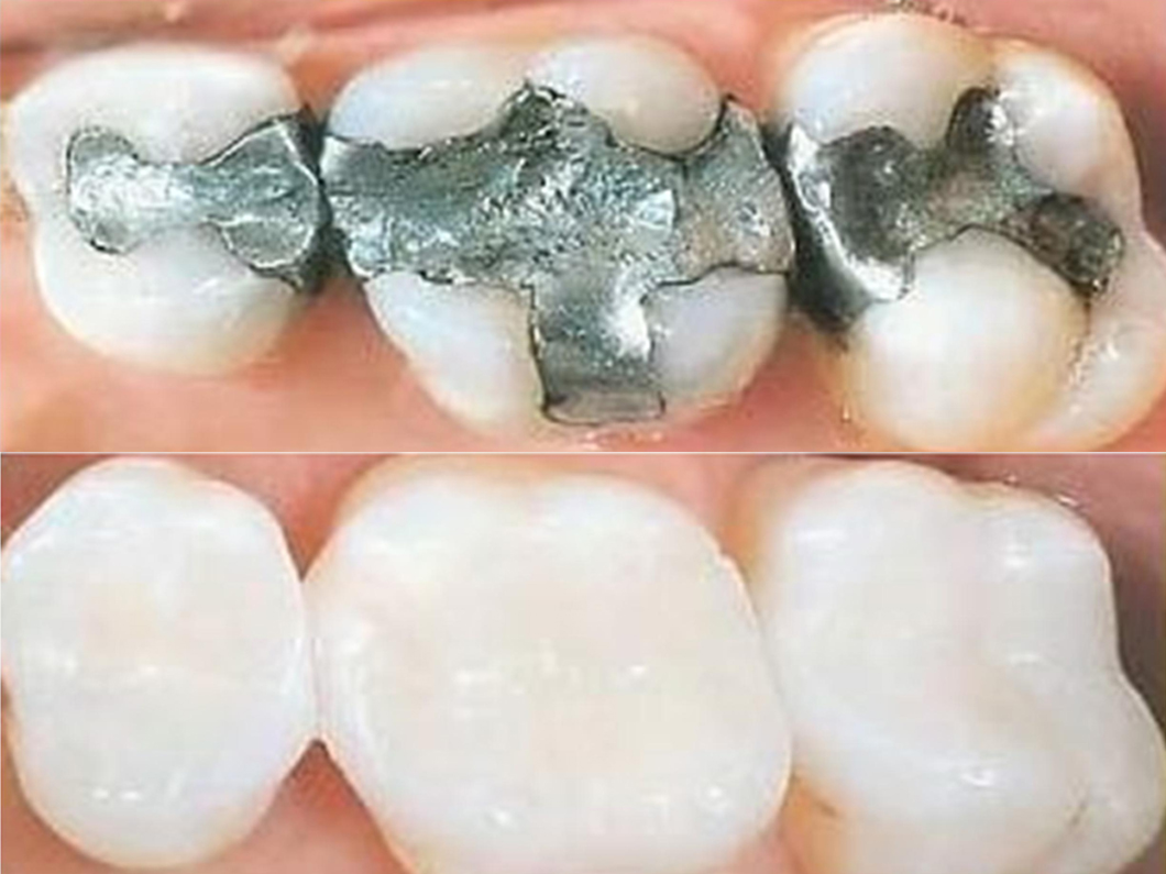  Restorative Dentistry
