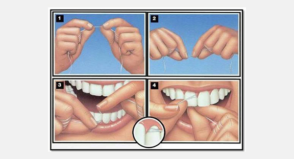 Why Flossing is Important?
